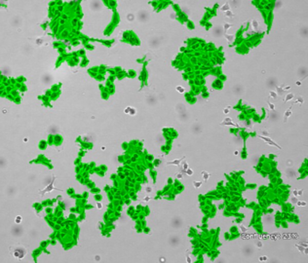 RMS RET Melanoma-sorted Mouse Cell Line | SCC462